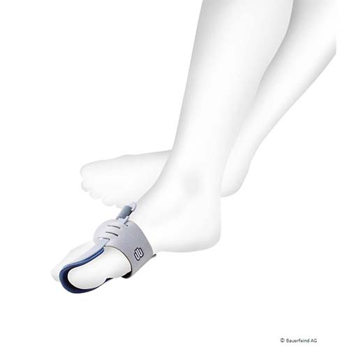 Hallux valgus-Nachtorthese